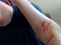 Wachsende Unsicherheit angeprangert