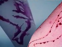 The Blue Whale Challenge