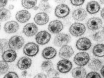 HI-Virus: Mehr Opfer und immer noch kein Haftbefehl