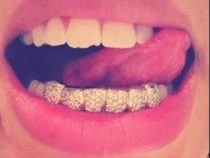 Überfallen, ermordet und Goldzähne herausgerissen