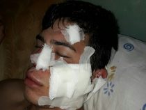 Bürgermeister aus Guairá in Schlägerei verwickelt