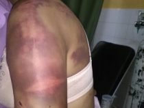 Ganz besonders schwerer Fall von familiärer Gewalt