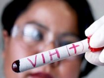 Aids-Test durch Arbeitgeber untersagt