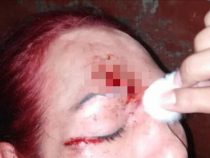 Die Transgender sind ein Problem