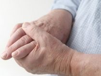 Arthritis auf dem Vormarsch