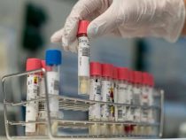 Weitere Sachverständige melden sich zum Thema Covid-19 zu Wort