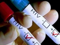 Kostenlose HIV-Tests wegen hoher Fallzahl