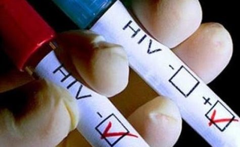 Ihr Exmann verbarg jahrelang seine HIV-Infektion, steckte sie an – und verschwand