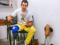 Prothese und Feuerwehrmann