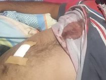 Ehefrau sticht Mann nieder