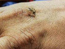 Nach 9 Jahren meldet das Gesundheitsministerium zwei Fälle des Dengue-Serotyps DENV-3