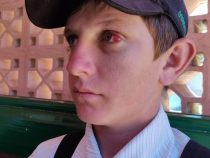 Mennonitischer Jugendlicher soll nach Prügelstrafe endlich operiert werden