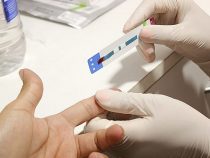 Die neue Epidemie: HIV dank ungeschütztem Sex