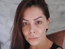 Ex-Model hat lauter Blutergüsse im Gesicht