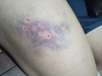 Transperson angriffen und die Polizei weigert sich angeblich, die Anzeige aufzunehmen