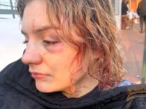 Frau ohne ersichtlichen Grund von einem angeblich psychisch Gestörten angegriffen