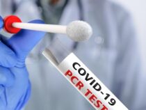 PCR-Test für Covid-19 nur auf ärztliche Anordnung