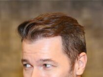 Vorteile einer Haartransplantation in der Türkei