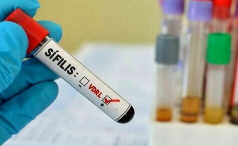 Das weltweite Comeback der Syphilis: Wie Paraguay gegen den rasanten Anstieg von STI kämpft