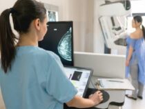 Mammographien ohne ärztliche Anordnung möglich
