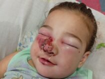 Einjährige Kämpferin Emily ringt in Asunción um ihr Leben