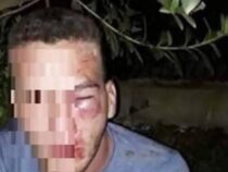 Mann verabredete sich mit einer 12-Jährigen und erlebte sein blaues Wunder