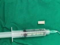 3-jähriges Mädchen verschluckt eine Pfeife: “Wenn sie lachte, pfiff sie, sie wurde zur Trompete“, sagt der Arzt