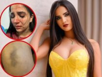 Skandal in der Justiz: Mitarbeiter wegen mutmaßlicher Gewalt gegen Model angezeigt