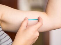 Familienplanung 2026: Das subdermale Implantat als Schlüssel zur Senkung der Jugendschwangerschaften