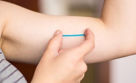 Familienplanung 2026: Das subdermale Implantat als Schlüssel zur Senkung der Jugendschwangerschaften