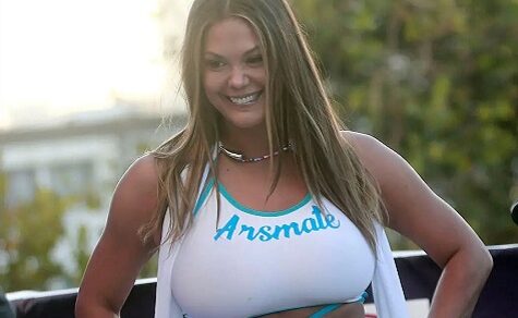 Wunder auf dem Laufsteg: Paraguayisches Model läuft nach zwei Jahren erstmals ohne Krücken